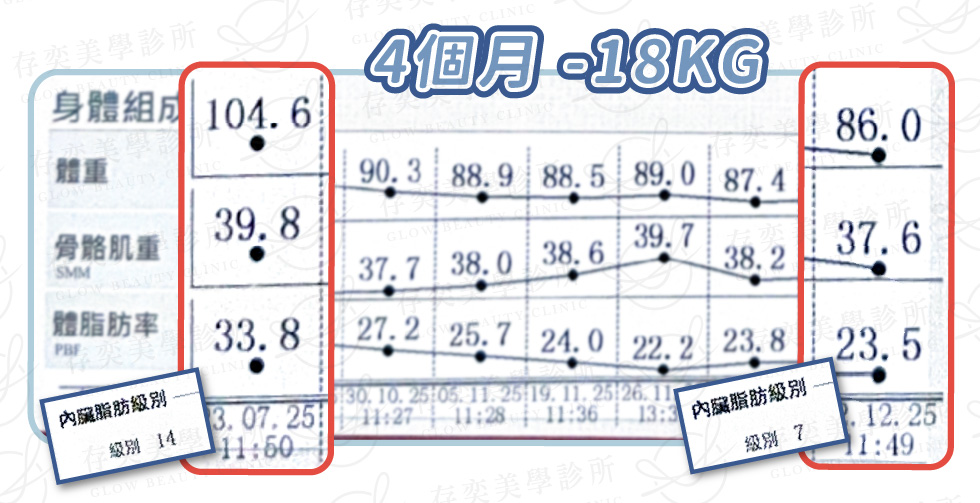 老馮 inbody數據圖_術後