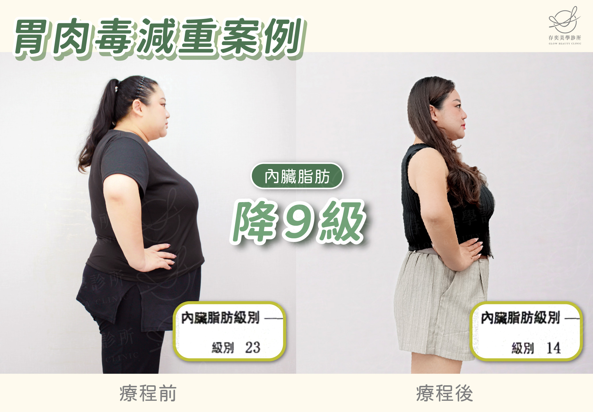陳雅勤減重BA-內臟脂肪降9級
