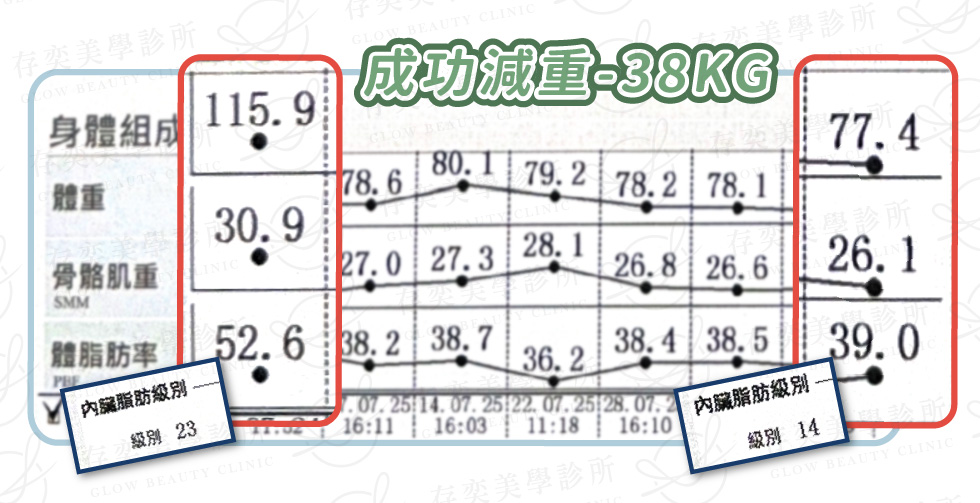 陳雅勤 inbody數據圖_術後