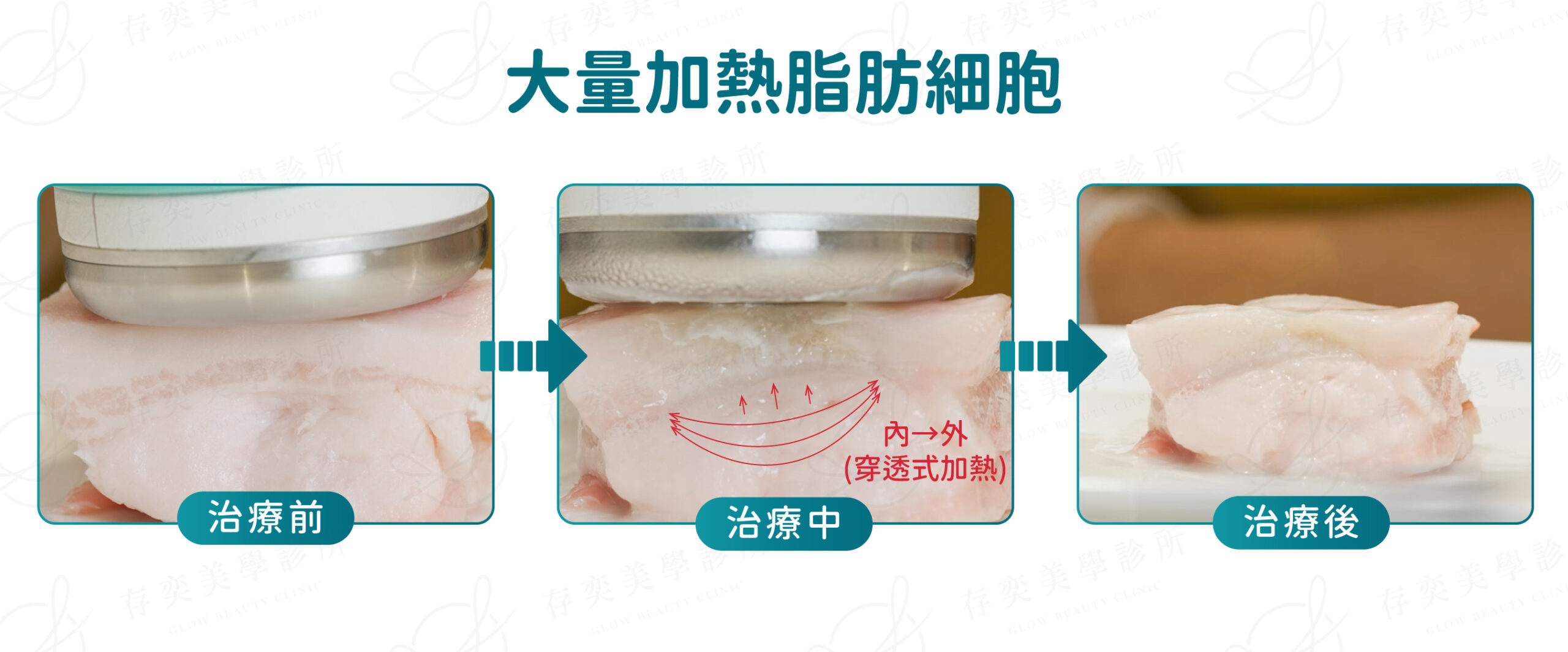 0727_ONDA比較-12