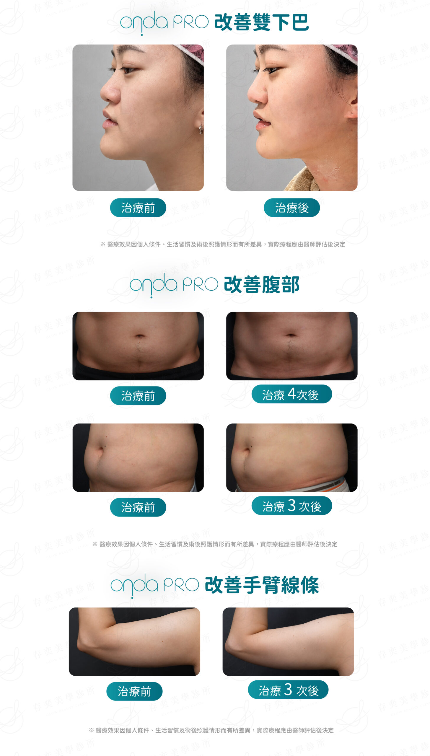 0727_ONDA比較_比較圖