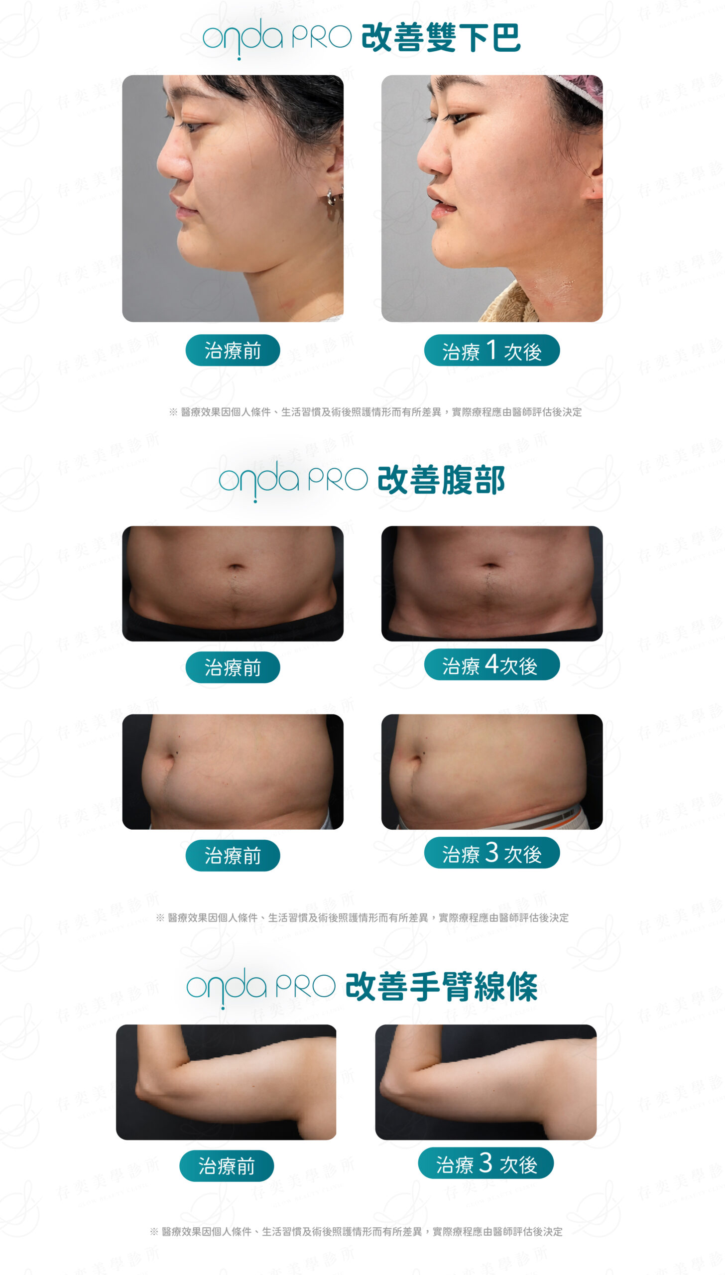 0727_ONDA比較_比較圖