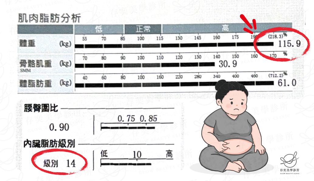 陳雅勤 inbody數據圖_術前2