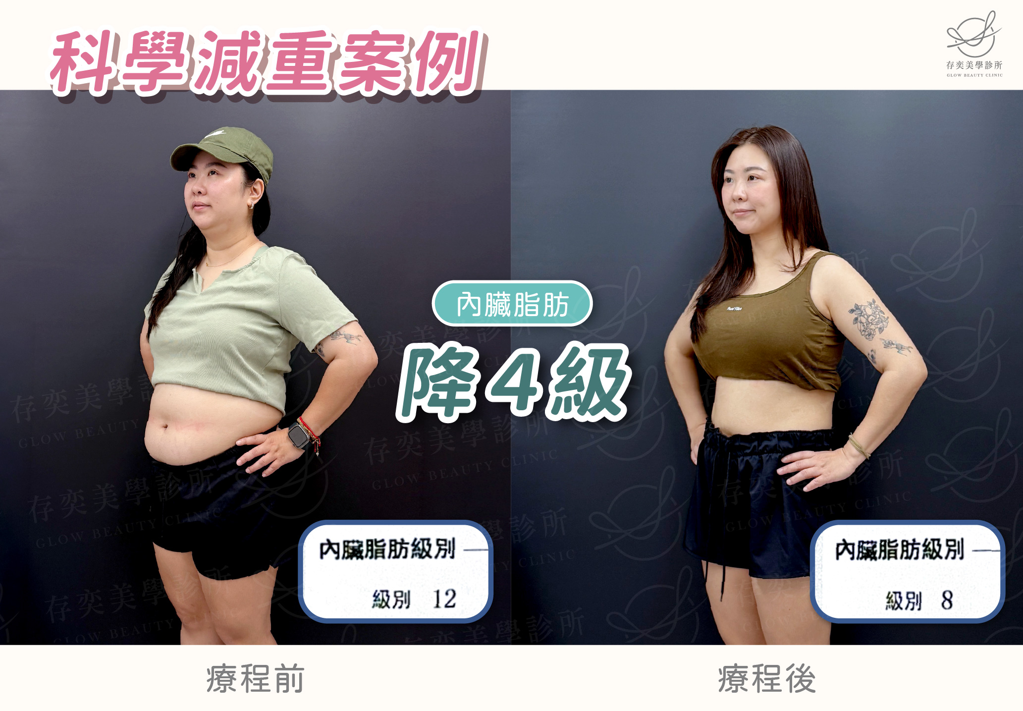 周欣儀減重BA-內臟脂肪降4級