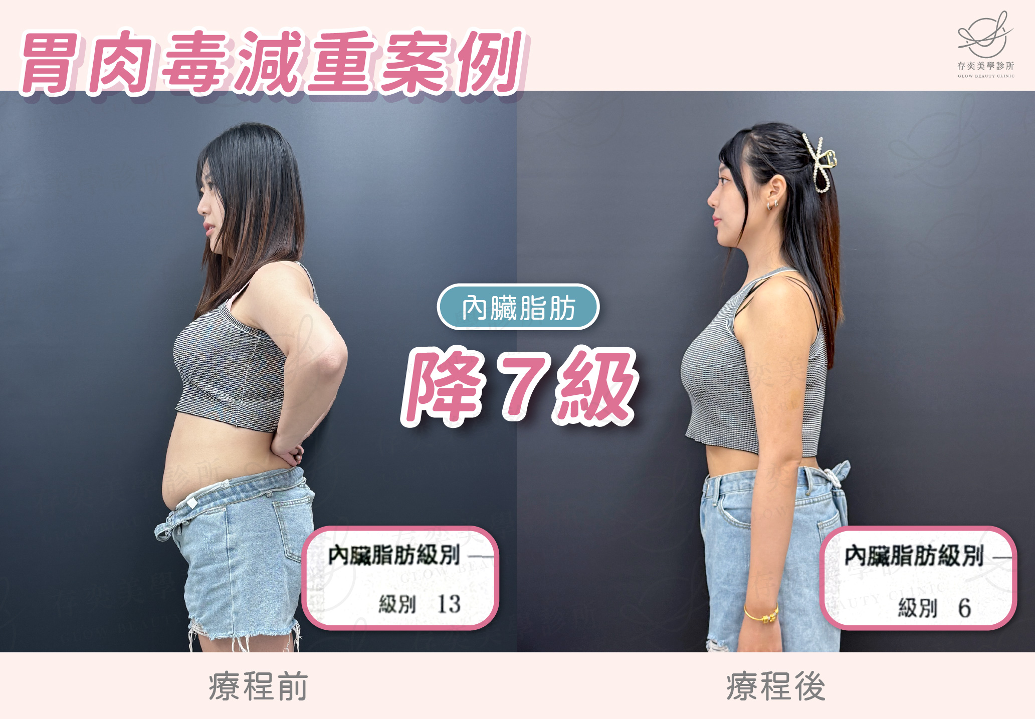 妮妮減重BA-內臟脂肪降7級