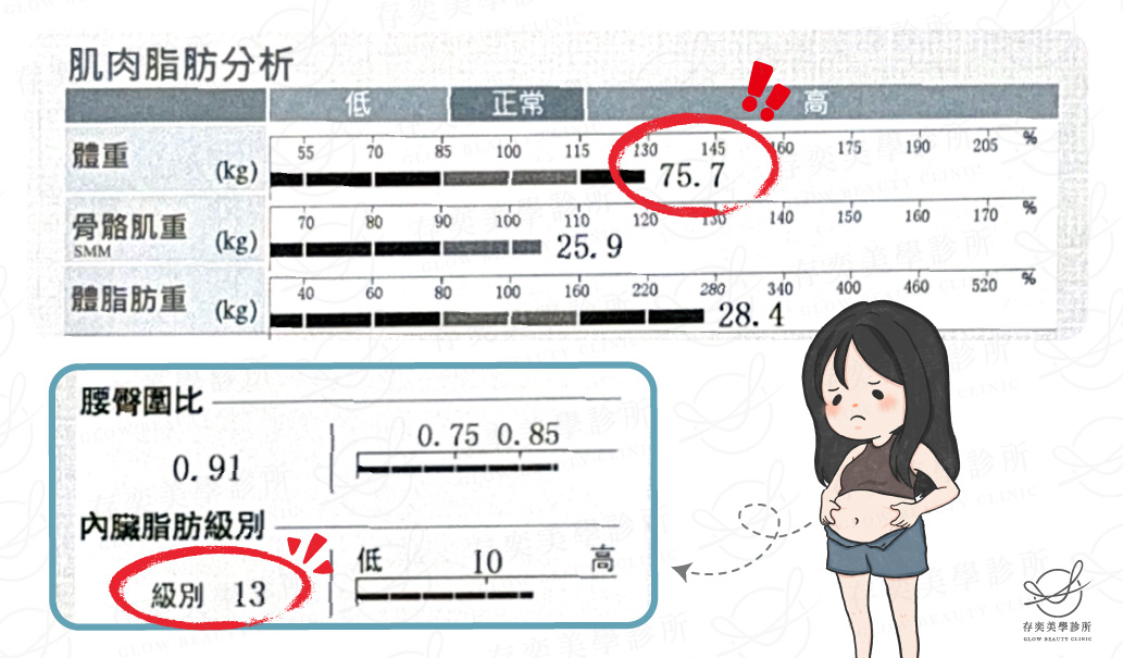 妮妮 inbody數據圖_術前