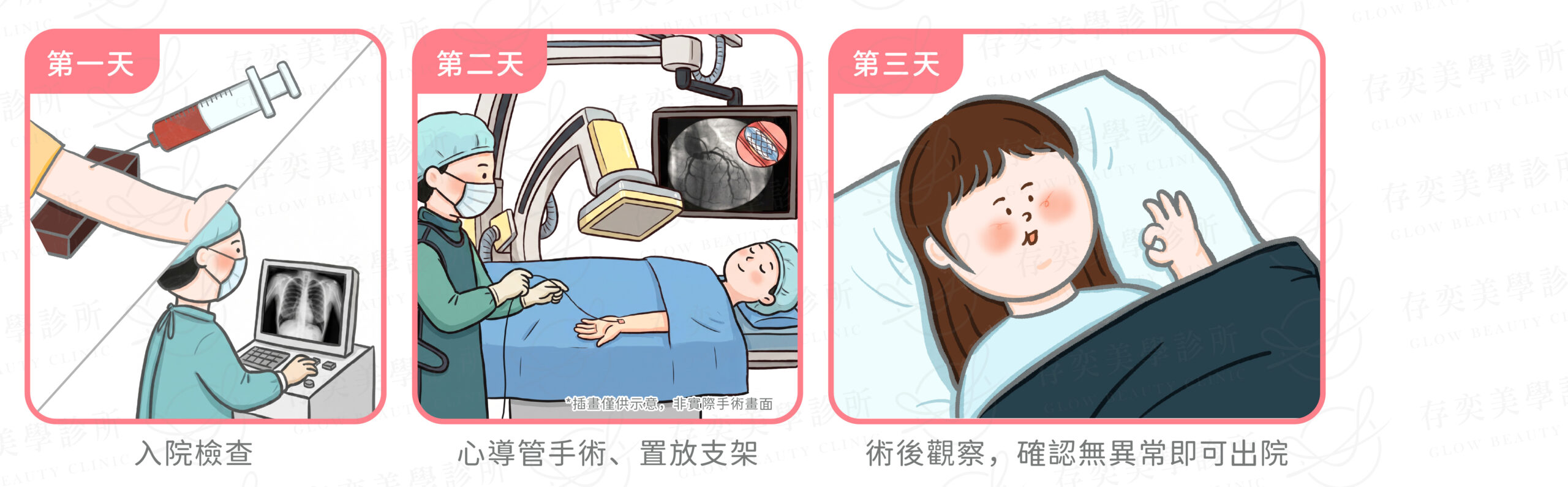 心臟支架手術流程v2