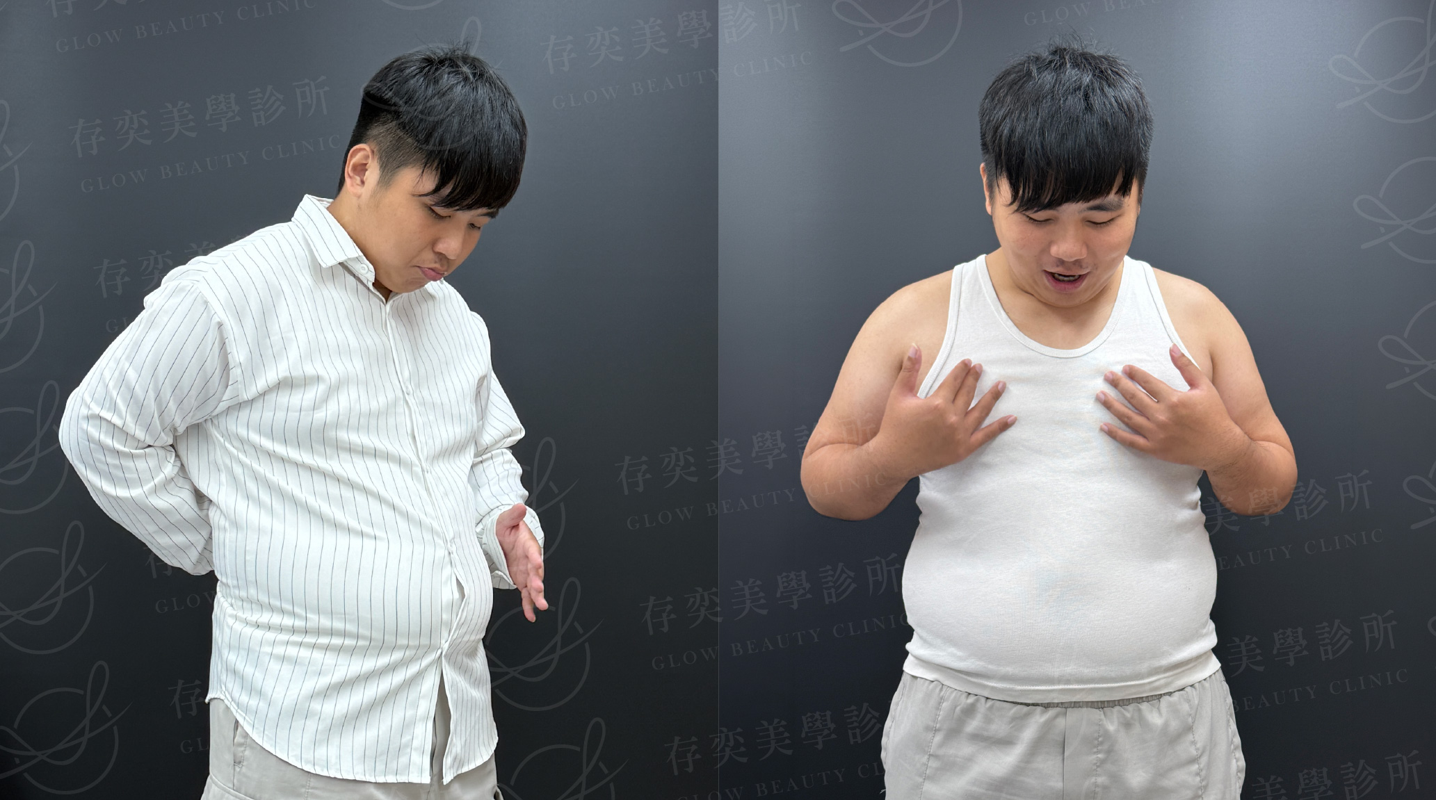 鄭育瑜減重_術前照