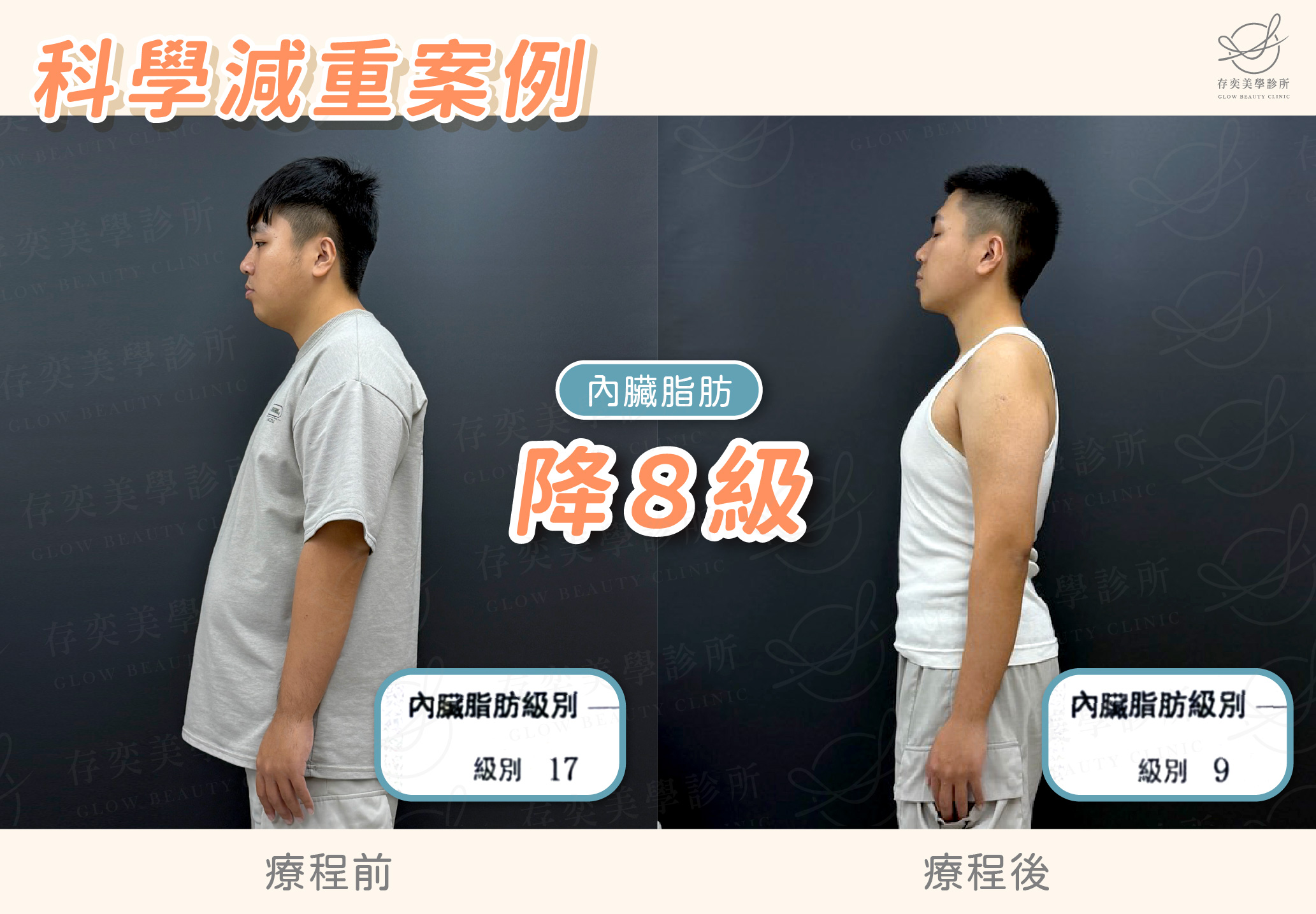 鄭育瑜 減重BA-內臟脂肪減8級