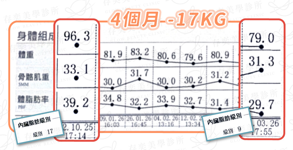 鄭育瑜 inbody數據圖_術後